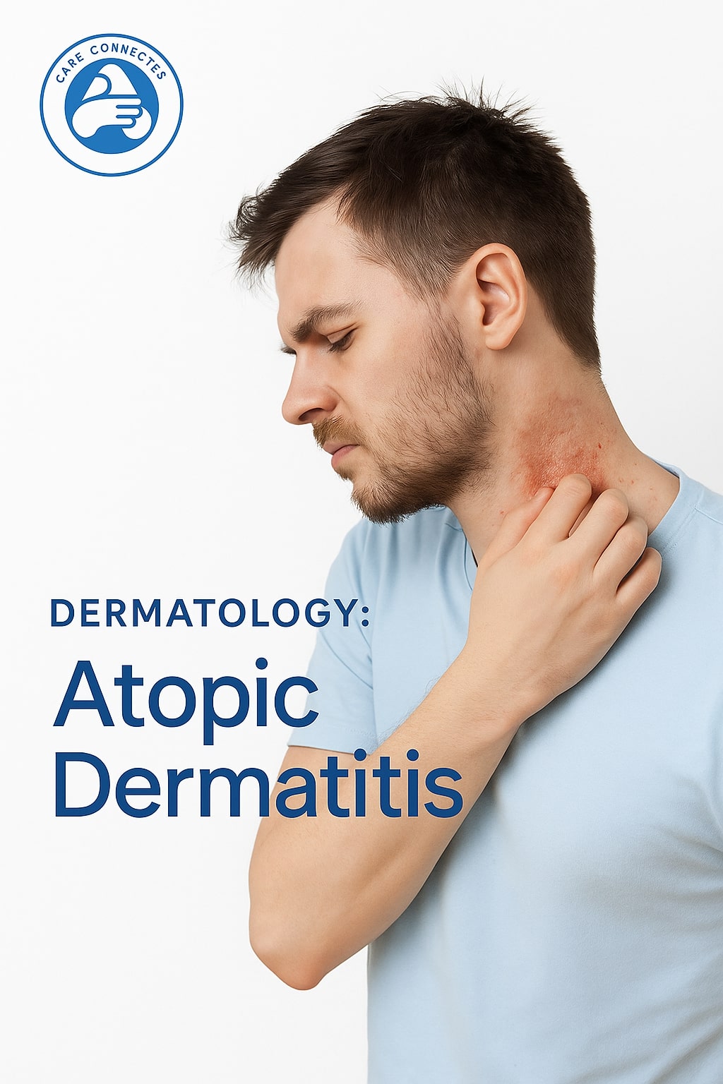 Dermatology: Atopic Dermatitis